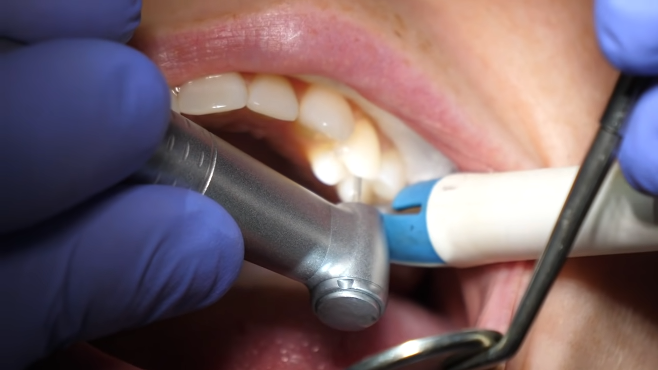 teeth